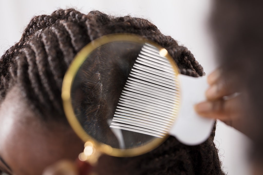 can-african-americans-get-lice-licedoctors-licedoctors